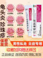 Erythromycin ointment medicine male balanitis special medicine foreskin inflammation fungal infection private anti-inflammatory ointment acne. 