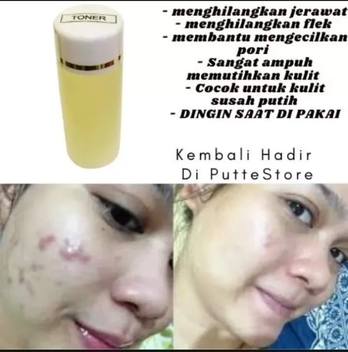 TONER%20STRONG%20/%20TONER%20FLEK%20/TONER%20DINGIN%20/%20TONER%20WHITENING%20FLEK%20/%20TONER%20PENGHILANG%20FLEK%20DAN%20JERAWAT%20MENCERAHKAN%20DIJAMIN%20DINGIN%20DAN%20STRONG%20ISI%2060ML%20-%20Image%202