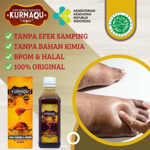 Obat Kaki Asam Urat Rematik Kaki Bengkak & Nyeri Diabetes Jantung Herbal Pergelangan Kaki Bengkak Dengan Sari Kurma Madu Original KURMAQU TRADISIONAL
