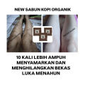 Lotion Pemutih Kulit BPOM Alpha Arbutin Mencerahkan & Melembabkan Permanen - Pemutih Kulit Cepat & Aman untuk Bumil dan Busui - COD. 
