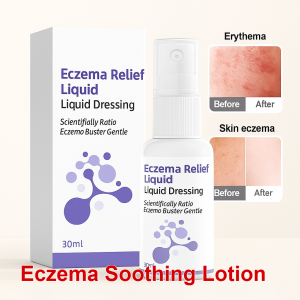 30ML Skin Care Liquid Dressing Relieves Itchy Skin Eczema Killer Spray Herbal Skin Cream 湿疹克星 皮肤护理液体敷料
