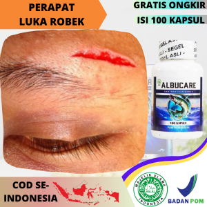 Obat Perapat Luka Robek Untuk Menutup Luka Kulit Sobek Herbal Alami Merapatkan Jahitan Terbuka Di Perut Kepala Tangan Kaki Luka Sayatan Terkena Paku Pisau Benda Tajam Suplemen Pengering Luka Robek Wasir Fisula Ani Di Anus Dubur Pria Wanita - Albucare