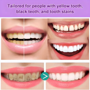 Purple Toothpaste Dental Care Oral Cleaning Purple Dental Care Toothpaste