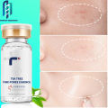 Fair King Tea Tree Fine Pores Essence Shrink Pores And Smooth Skin Mengecilkan Pori-pori Dan Menghaluskan Kulit. 