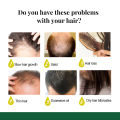 Eelhoe 7 Day Ginger Germinal Serum Essence Oil Hair Loss Treatment Effective Fast Growth Hair Care Ginger Hair Loss Treatment Fast Hair Regrowth Essential Oil 7 Days Anti-loss Strong the Root of Hair Serum. 