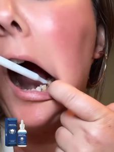 Xịt chăm sóc răng miệng bảo vệ vệ sinh và giảm vết ố. Răng sạch tự nhiên thơm mát và bóng khỏe.