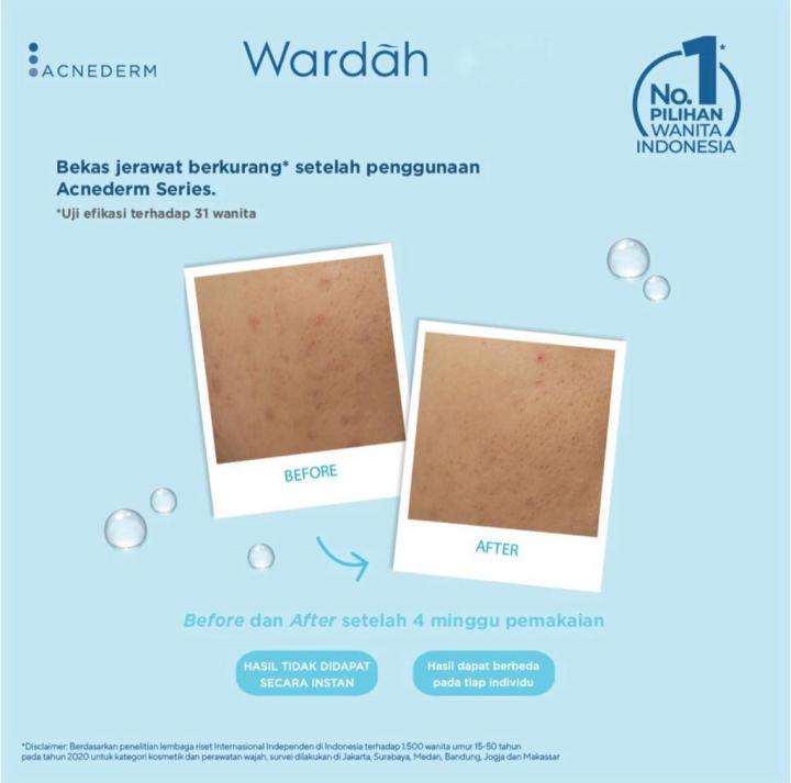 Wardah%20Acnederm%20Pure%20Foaming%20Cleanser%2060%20ml%20-%20Facial%20Wash%20dengan%20Allantoin%20-%20Pembersih%20Wajah%20Berjerawat%20-%20Image%207