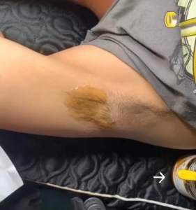 Sáp Wax Lông Shiny -Triệt Lông Tận GốcTriệt Lông Tại NhàTẩy Lông An Toàn Không Đau ( Tặng bộ Giấy và que Wax )
