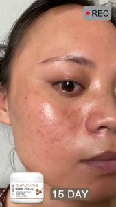 Glutathione Cream 50g Whitening Facial Cream Dark Spot Remover Anti Aging Brightening Skin Care Moisturizing Face Cream Lanthome...