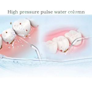 Universal Replacement Tips High-Pressure Water Flosser Jet Tip for Waterpik Oral Irrigators Durable Periodontal Tips