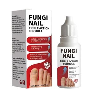 LIMITED STOCK Varicose Veins Spray Varicose Veins Treatment Spray Leg Pain Relief Swelling Repair Blood Circulation Daily Leg Care Gamot Sa Varicose Veins