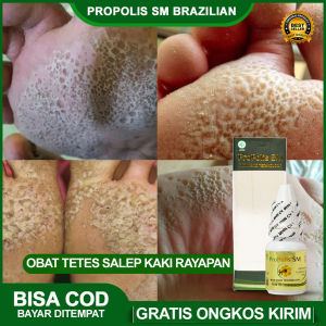 Obat Tetes Kaki Rayapan Bau Kaki Bolong Kaki Bolong Berlubang Salep Kaki Pecah Pecah Kutu Air Cantengan Sembuhkan Kaki Rayapan - Propolis Sm 100% Original Terlaris