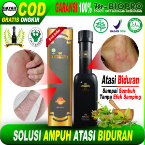 Mbiopro Herbal Asli Original Ampuh Atasi Biduran Alergi Dingin Alergi Makanan Kulit Bentol Gatal | Mbiopro BPOM