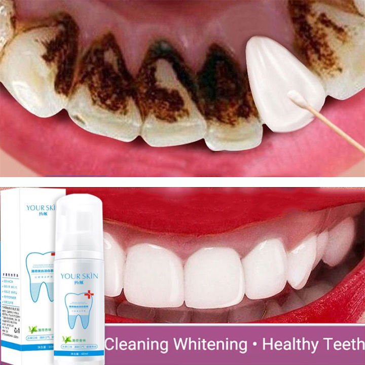 COD YOUR SKIN Teeth Whitening Teeth Cleaning Mousse White Teeth Oral Hygiene Toothpaste Whitening Remove Lazada PH