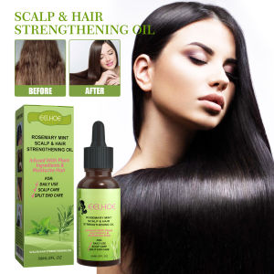 eelhoe Organics Rosemary Mint Scalp & Hair Strengthening Oil for All Hair Types Rosemary Mint Scalp Hair Strengthening Oil Biotin Essential Oil Nourishing Treatment Split Ends Dry All Types Hair Growth Essential Oil Rosemary Mint Hair Strengthening Oil