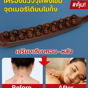 แท่งชีจิน เว้า จุด เส้นเมอริเดียนไร้เสี้ยน ไม้ฝังเข็มเส้นลมปราณทั่วร่างกาย เครื่องขูดเส้นเอ็น