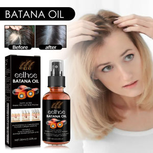 EELHOE Batana Perawatan Rambut Semprot Perawatan Rambut Kulit Kepala Pelembab Dalam Penyetap Rambut Kulit Kepala yang Kuat Nutrisi Kuat  EELHOE Battana Hair Care Spray Deep Moisturizing Scalp Repair Hair Tough Nutritious Hair Care Spray