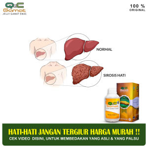 Obat Kerusakan Hati Gangguan Fungsi Hati Hepatitis A B Perlemakan Hati Liver Penyakit Kuning Batu Empedu Mual Muntah Nyeri Perut Asites Perut Bengkak Kaki Bengkak dengan QNC JELLY GAMAT Sudah BPOM & Halal MUI
