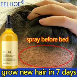 Fast Hair Growth Oil Africa Crazy Traction Alopecia Serum Anti Hair Break Thicken Hair Loss Treatment Spray For Man Women 60ML2026