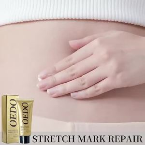 OEDO Rose Remove Stretch Marks Cream Anti Aging Skin Repair Remove Pregnancy Scars Treatment Body Skin Care 40g