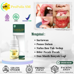 Obat Sariawan Parah - Obat Sariawan Di Mulut/Lidah/Bibir Obat Sariawan Anak dan Dewasa Obat Panas Dalam Obat Radang Sariawan Obat Nafas Bau Tak Sedap Dengan ProPolis SM