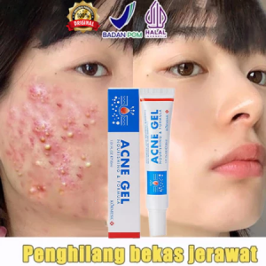 Acne Gel 30ml Obat Jerawat Wajah Perawatan Jerawat Efektif Wajah Spot Treatment Acne Obat Totol Jerawat Acne Treatment