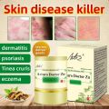 Skin Herbal Psoriasis Dermatitis Eczema Pruritus Psoriasis Cream 