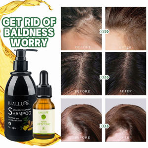 RestorehairstyleNourishingHairRootHairgrowthsprayAntihairLossLiquid30mlImprovehairfolliclesDenseHair