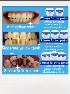 Probiotic tooth cleaning powder 50g teeth whitening Pemutih Gigi powder Serbuk Ubat Gigi Removes Plaque Stain 美白牙粉