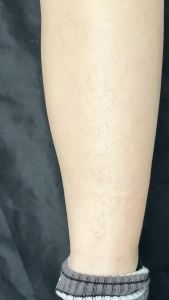 Roll on Wax Refill: 4 Honey Wax Roller Refill - At-Home Hair Removal Cartridge for Body Legs Arms (100g/3.53oz 4 Pack)