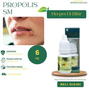 Obat Untuk Herpes Di Bibir Infeksi Jamur Di Bibir Bibir Gatal Bintik Putih Penyakit Herpes Di Mulut Menghilangkan Bekas Luka Herpes Dengan Propolis SM