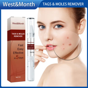 West Month Tags Moles Remover Pen Mole Remover Tags Remover Warts Warts Remover Original Cream Painless Mole Warts Freckle Remover Machine Facial Body Hand Freckle Wart Dark Spot Skin Blackhead Blemish Pimple Treatment Liquid Ointment(3ml)
