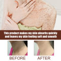 Jaysuing Coffee Body Scrub Acanthosis Nigricans Exfoliators Whitening Moisturizing Brighten Knees Underarm Back Melanin Dark Spots Deep Cleansing Scrub Roughness And Dullness Skin Care 50g. 
