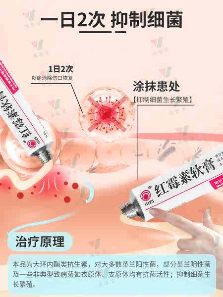 Erythromycin%20ointment%20medicine%20male%20balanitis%20special%20medicine%20foreskin%20inflammation%20fungal%20infection%20private%20anti-inflammatory%20ointment%20acne%20-%20Image%205
