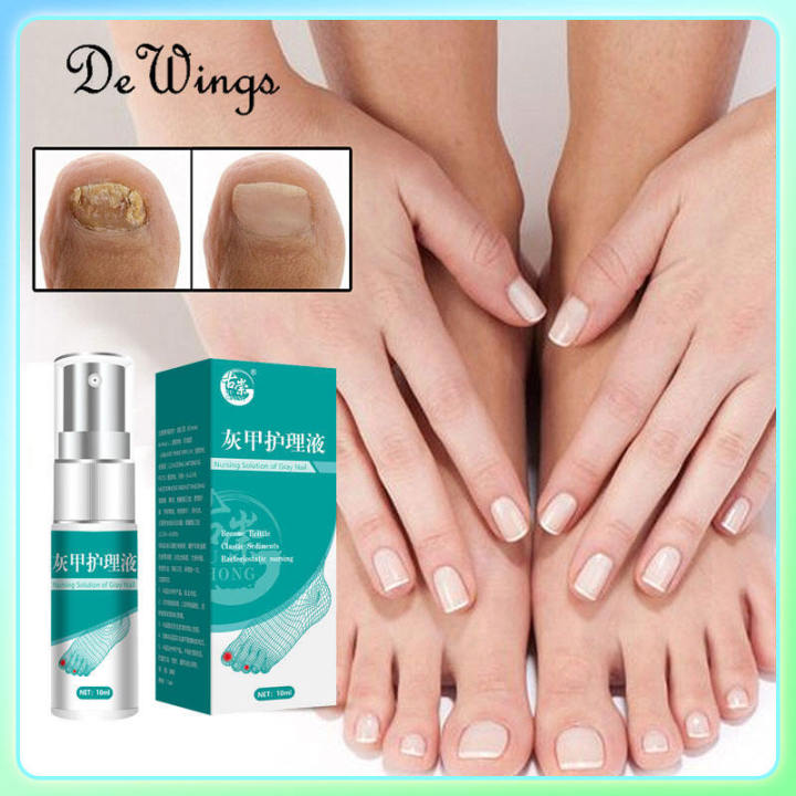 100 herbal nail repair cream, antifungal nail infection, onychomycosis