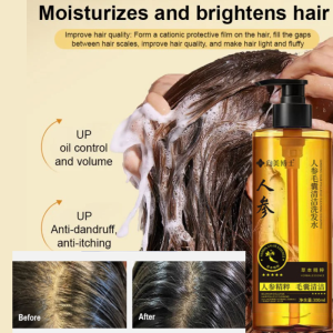 🥳Big Discount 🥳Ginseng Shampoo For Hair Growth Deep Cleansing Follicles Volumizing Scalp Care Dandruff Control Oil Balance For Thinning Hair Treatment Natural Dandruff Remedy Shampoo Ginseng Shampoo Deep Cleansing Oil Balance