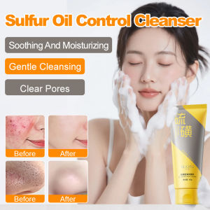 Sulfur Oil Control Facial Cleanser Deep Cleansing Oily Skin Prevents Tightness Soothing Hydration Balances Sebum Production Sulfur Face Wash Oil Control Cleanser Pore Purifying