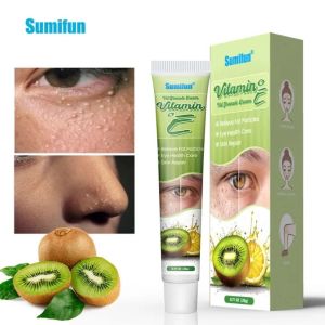 Kem Mắt Vitamin E Đánh Bay Mụn Li Ti Vùng Mắt Chỉ Sau 1 Tuần - Giảm Rõ Rệt Mụn Thịt Thâm Quầng