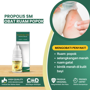 Obat Ruam Popok Selangkangan Selangkangan Merah Pada bayi Salep Gatal Ruam Popok Bayi Obat Untuk Gatal Selangkangan Obat Bintik Merah Di Kulit Bayi Salep Gatal Bayi Obat Kulit Lecet Biang Keringat Penghilang Ruam - Propolis SM
