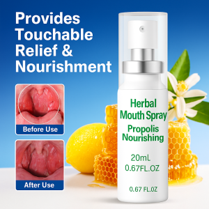Herbal Soothing Throat Spray Plant Extract Relief Spray Instant Soothing Relief for Dry Sore Itchy Throat Mouth Ulcer Treatment Spray