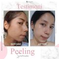 Ms Glow Peeling Serum - 100% original BPOM HALAL aman untuk bumil busui remaja semua jenis tipe kulit - untuk masalah kulit kusam, beruntusan dan jerawat, kulit terkelupas,. 
