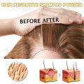 Eelhoe Hair Regrowth Shampoo Powder Ginger Strong Anti-Hair Loss Moisturizing Deep Cleansing Anti-Itching Non-Irritating Shampoo Powder Stimulate Hair Roots And Hair Improve Scalp Blood Circulation Hair Care 10pcs. 