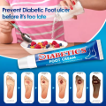 SUMIFUN Diabetes Wound Ointment Diabetic Wound Ointment Cream Diabetic Foot Cream Wounds Healing Cream Wound Healing. 