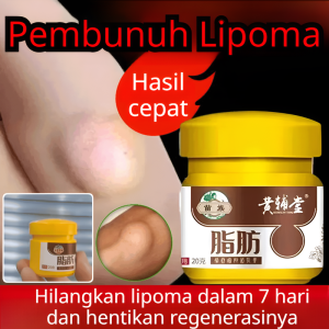 Krim penghilang lipoma obat lipoma untuk benjolan di leher/obat lipoma pengobatan herbal untuk tumor kulit yang bengkak/krim penghilang lipoma