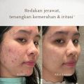 GBELLE Face Wash 3in1 Acne Moisturizing Brightening Cleansing Mousse 150m Pembersih Wajah Mencerahkan Facial Wash Massage Kulit Berjerawat Iritasi Kemerahan G-Belle. 