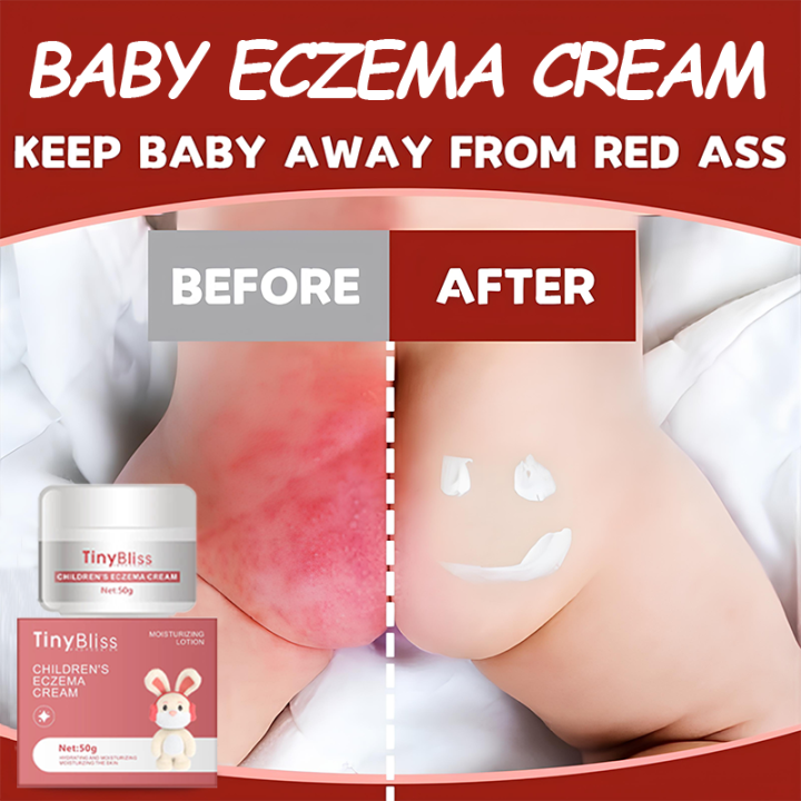 TinyBliss Baby eczema cream Hydrating Soothing Clean Ingredients All Over  Protection Safe For All Skin Babies 50g Lazada PH