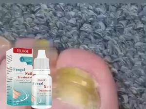 【Ready Stock】Nail Fungus Treatment Nail Repair Essence Cuticle Oil Nail Cares Nail White Lotion