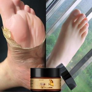Free Rm25 Aloe Vera Gel Hand Foot Crack Cream 30g Heel Chapped Peeling Foot and Hand Repair Anti Chapping Wrinkle Treatment Skin Cracking