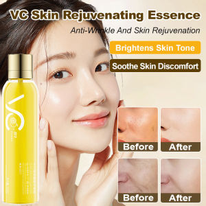 ✨Essence/Emulsion/Toner/VC Serum/Hydrating Lotion – For Sensitive Skin Soothing Long-lasting Moisture Anti-sensitivity Fade Dark Spots Hyaluronic Acid VC Glow Whitening Essence Water