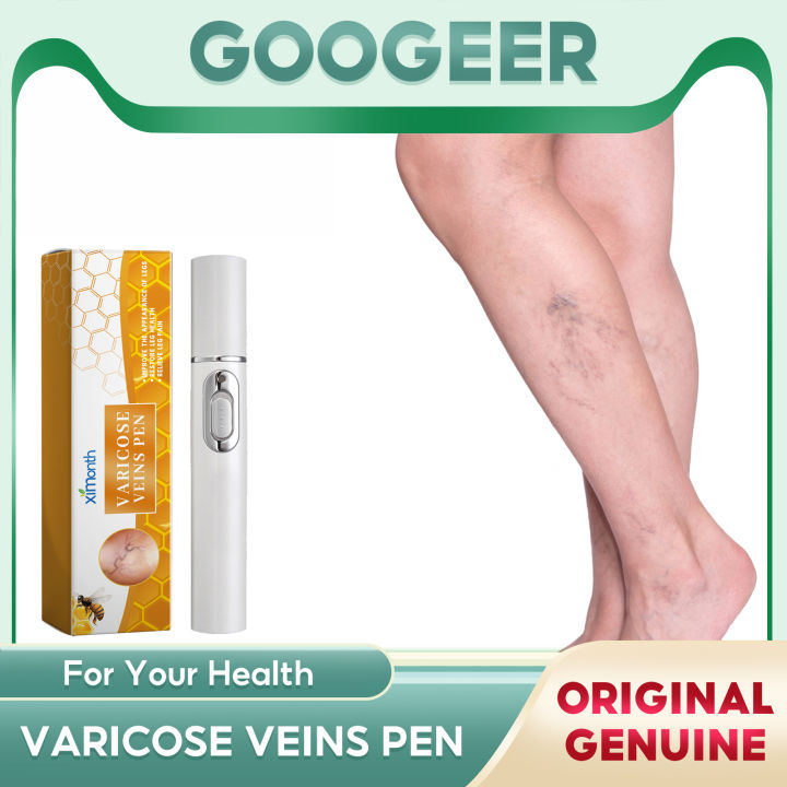 Ximonth Varicose Veins Pen Calf Spider Leg Phlebitis Vasculitis Anti
